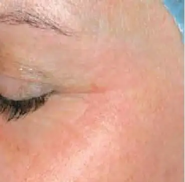 Close up of woman's eyes after