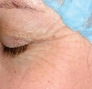 Close up of woman's eyes after before